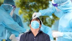 Điểm mặt các loại bệnh dịch nguy hiểm bắt nguồn từ động vật hoang dã