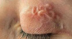 Dễ lây nhiễm giun sán từ thú cưng