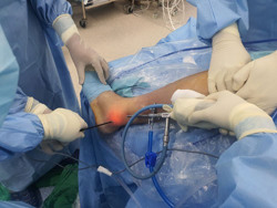 Nhập viện vì tập sai cách