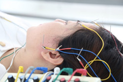 Không chủ quan với hiện tượng ù tai