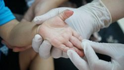 Ghi nhận một bệnh nhi tử vong do tay chân miệng