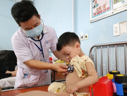 Bệnh Tay chân miệng gia tăng: Bộ Y tế có công văn khẩn