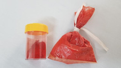 Nguy cơ ngộ độc từ phụ gia thực phẩm