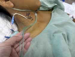 Ăn xôi có phẩm màu, nam thanh niên suy đa tạng