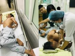 Nguy cơ tử vong do uốn ván từ vết thương ngoài da