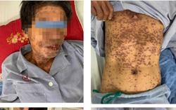 Thói quen chết người!