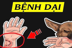 Cấp bách phòng bệnh dại