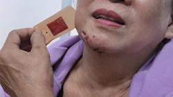 Cảnh báo bệnh dại vào mùa