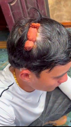 Đắk Lắk: Bắt giam 2 đối tượng để điều tra hành vi cố ý gây thương tích