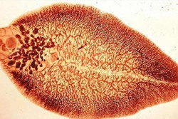 Mắc sán lá gan vì nghiện ăn rau sống