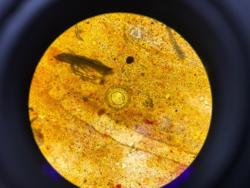 Phát hiện ca mắc sán dây chuột