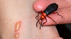 Nguy kịch sau khi ăn loại sâu giúp 'tăng cường sinh lý'