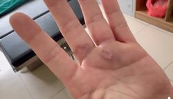 Bác sĩ cảnh báo nguy cơ nhiễm giun đũa từ nuôi chó mèo