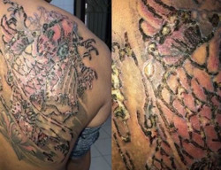 Trả giá vì hình xăm