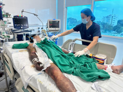 Bác sĩ cảnh báo nguy cơ suy đa tạng vì món ăn ‘lấy may’ đầu tháng