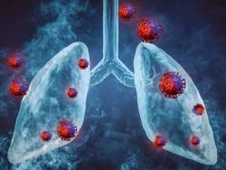 Bộ Y tế thông tin về virus gây bệnh viêm phổi trên người tại Trung Quốc