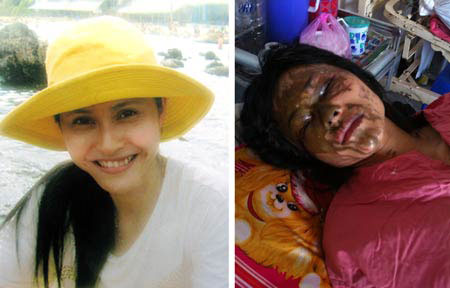 Nữ sinh ngành y trước và sau khi bị tấn công