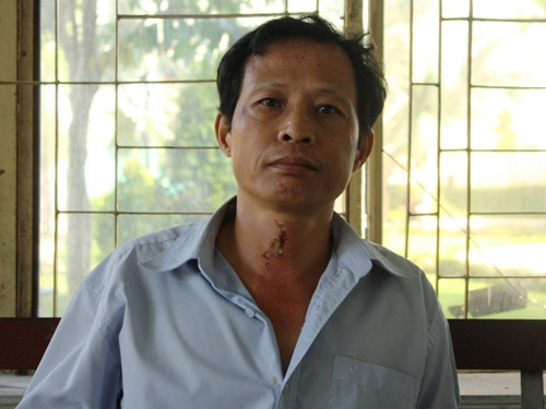 Lâm Tiến Dũng - kẻ tấn công gia đình anh Nguyễn Quốc Tuấn sau đó được chứng nhận là bị tâm thần