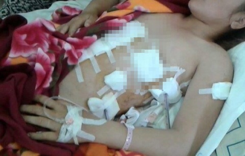 Chị Lê Thị Na bị đâm 7 nhát trên cơ thể. Ảnh nạn nhân cung cấp